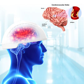 الصدمة الدماغية إصابة الدماغ أجهزة Photobiomodulation 810nm الطول الموجي